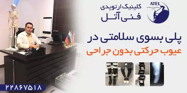 پای ایکس (ضربدری) چیست؟ روش های درمان آن