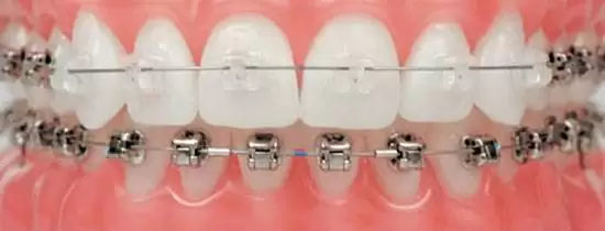 کلینیک تخصصی ارتودنسی و ناهنجاری های فک و صورت