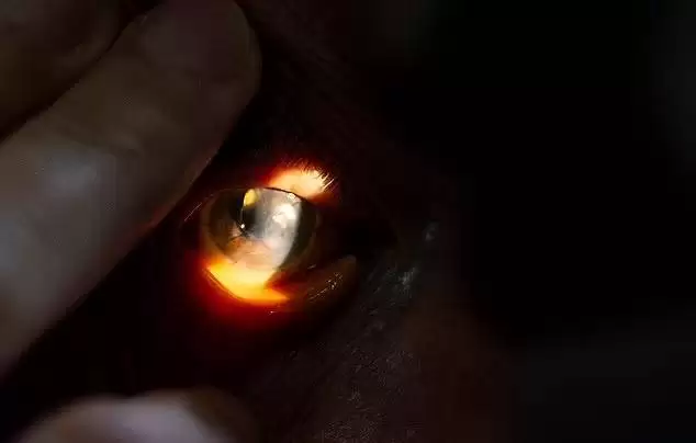 (تصاویر) انجام موفقیت آمیز نخستین پیوند قرنیه مصنوعی جهان برای پیرمرد 91 ساله