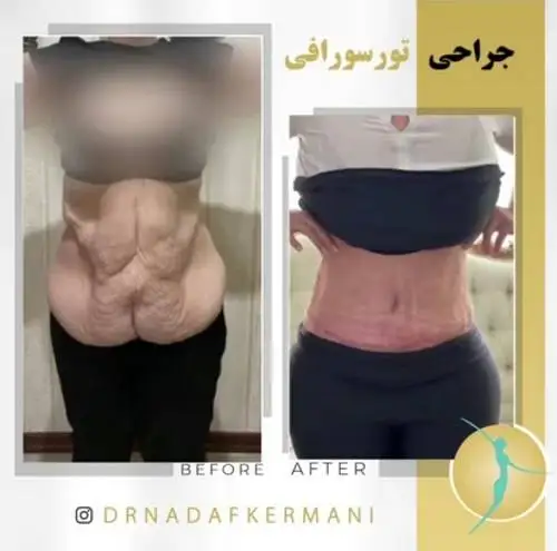 فوق تخصص جراحی پلاستیک و زیبایی در تهران - دکتر مجید نداف کرمانی