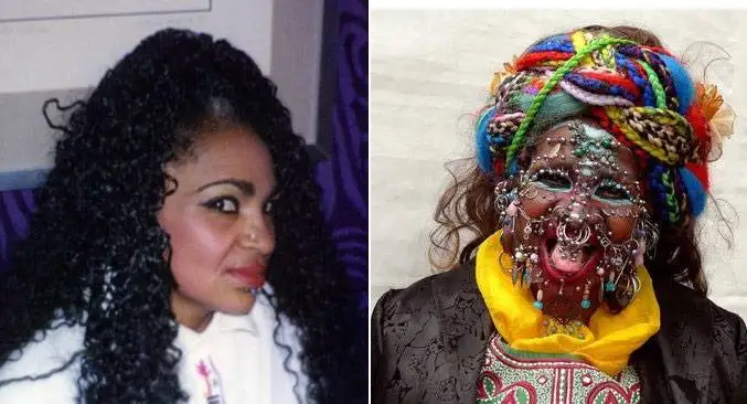 چهره این افراد بعد از جراحی عجیب از آدمیزاد برگشت