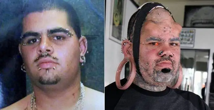 چهره این افراد بعد از جراحی عجیب از آدمیزاد برگشت