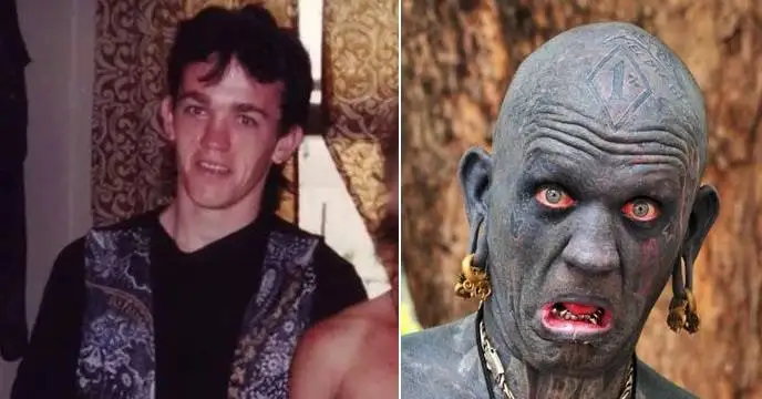 چهره این افراد بعد از جراحی عجیب از آدمیزاد برگشت