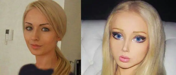 چهره این افراد بعد از جراحی عجیب از آدمیزاد برگشت