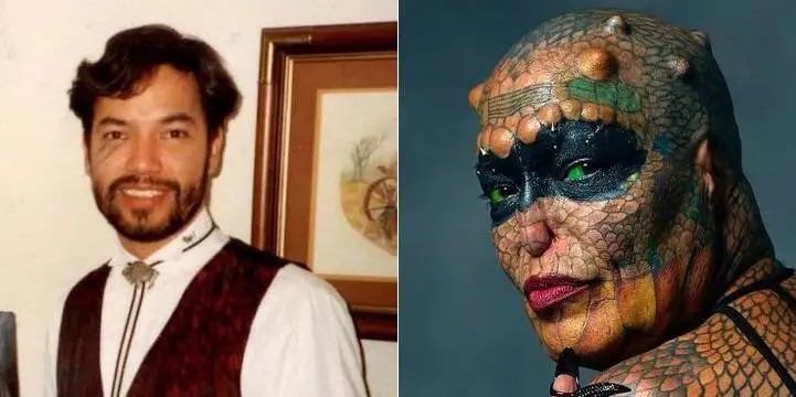 چهره این افراد بعد از جراحی عجیب از آدمیزاد برگشت