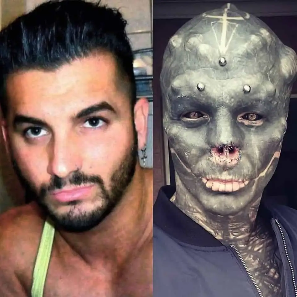 چهره این افراد بعد از جراحی عجیب از آدمیزاد برگشت