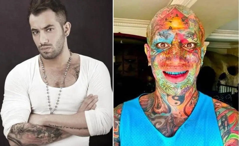 چهره این افراد بعد از جراحی عجیب از آدمیزاد برگشت