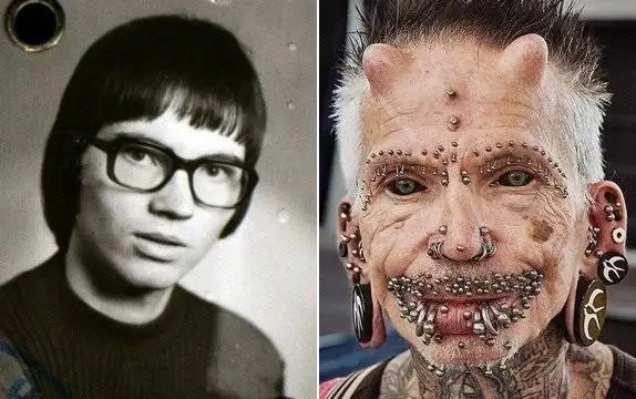 چهره این افراد بعد از جراحی عجیب از آدمیزاد برگشت