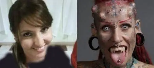 چهره این افراد بعد از جراحی عجیب از آدمیزاد برگشت