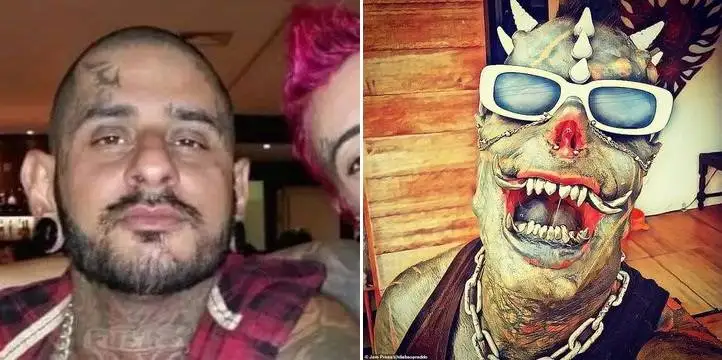 چهره این افراد بعد از جراحی عجیب از آدمیزاد برگشت