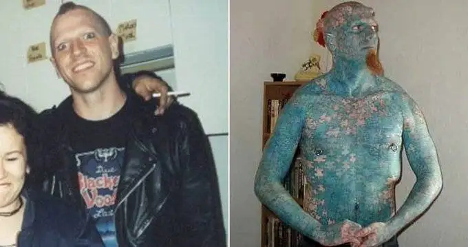 چهره این افراد بعد از جراحی عجیب از آدمیزاد برگشت