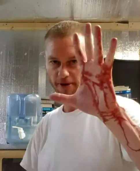 عکس؛ ساخت پادزهری بی سابقه با کمک دانشمندی که بیش از 200 بار توسط مارهای سمی گزیده شد!