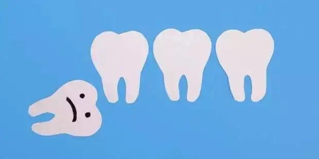 نقش دندان عقل در بدن انسان چیست و آیا کشیدن آن ضروری است؟