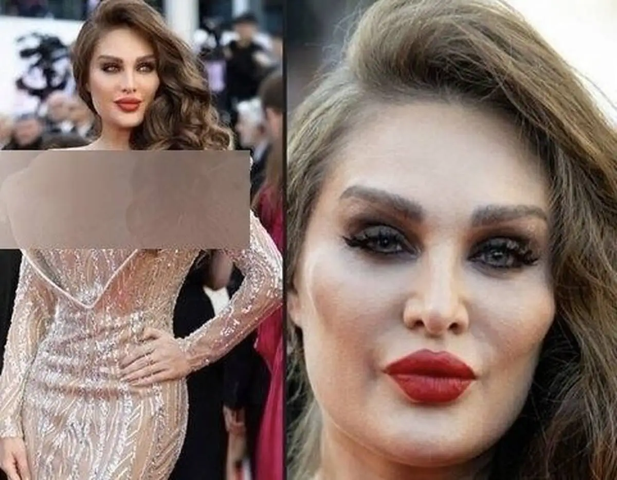 زیبایی جعلی طلا گلزار در سواحل شهر کن دفن شد