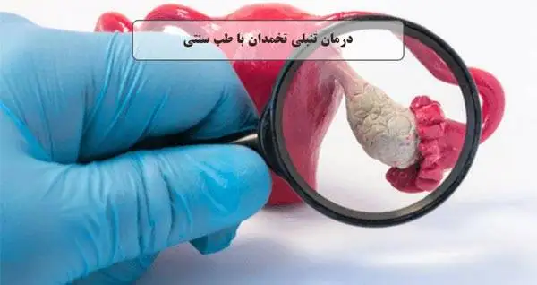 درمان تنبلی تخمدان در خانه ؛ بهترین روش های طبیعی و سریع تقویت تخمدان و تنظیم قاعدگی در منزل