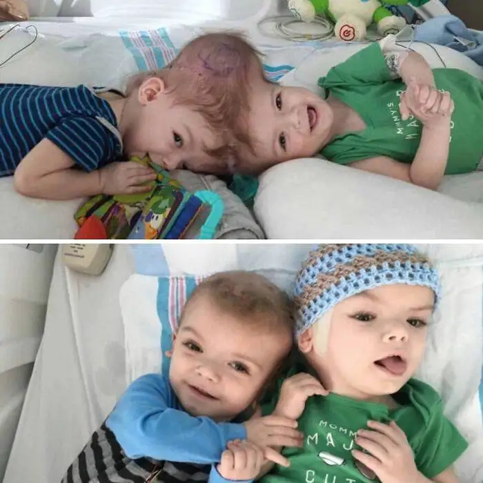 طعم گیلاس؟ آن ها با پزشکی مدرن به زندگی بازگشتند!