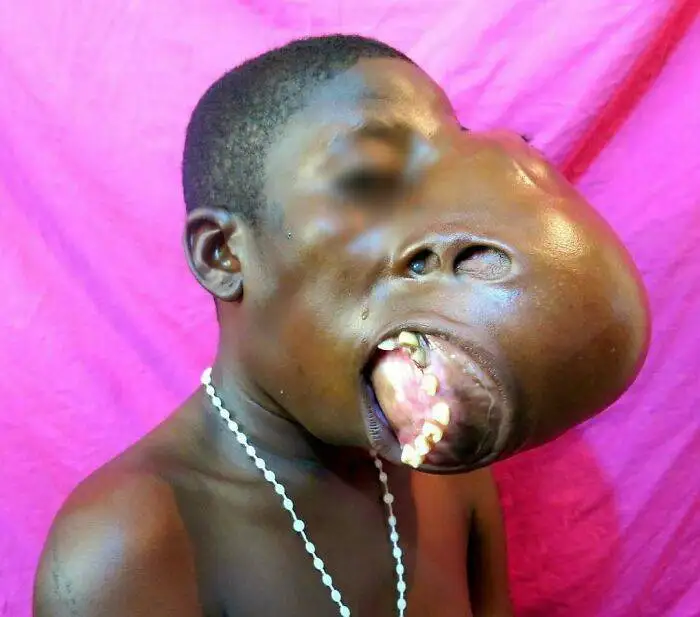 طعم گیلاس؟ آن ها با پزشکی مدرن به زندگی بازگشتند!