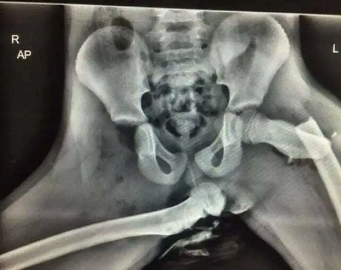 طعم گیلاس؟ آن ها با پزشکی مدرن به زندگی بازگشتند!