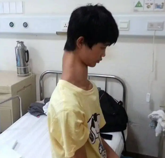 طعم گیلاس؟ آن ها با پزشکی مدرن به زندگی بازگشتند!