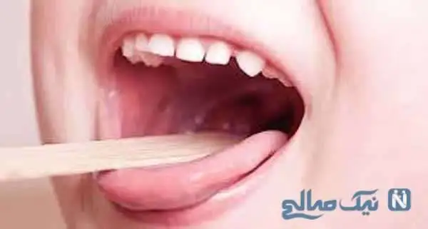 بهترین روش های درمان گلو درد در منزل؛ راهکارهای سریع و موثر خانگی