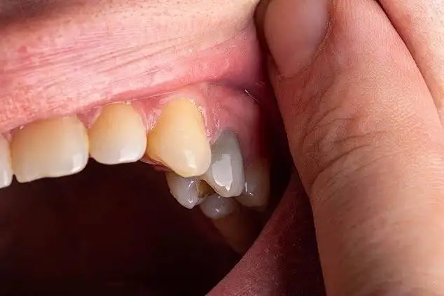 تصاویر؛ رنگ دندان از دیدگاه علم چه چیزهایی درباره سلامت شما می گوید؟