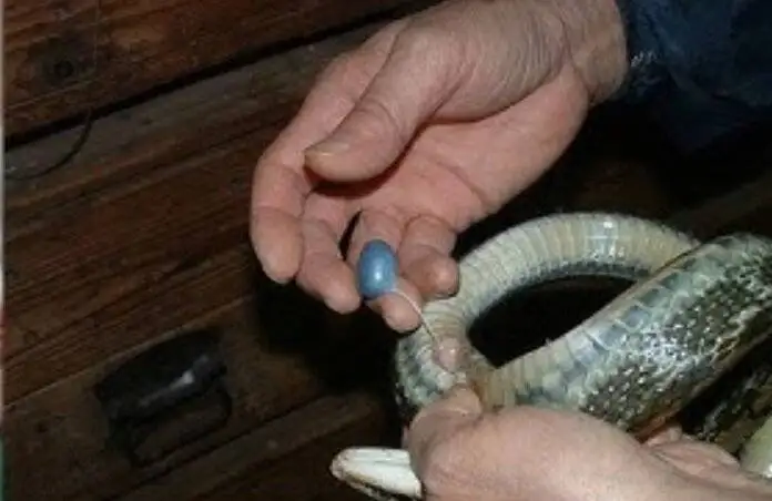 عکس؛ خارج کردن کرم 18 سانتی متری از مغز یک مرد