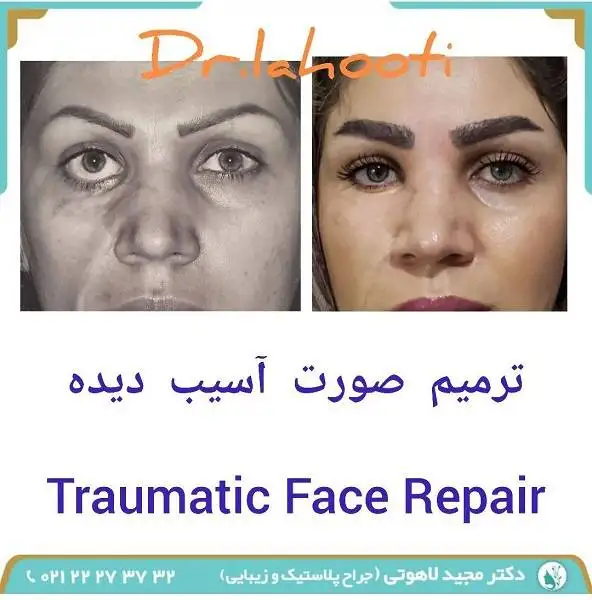 جراحی ترمیم صورت چگونه انجام می شود؟