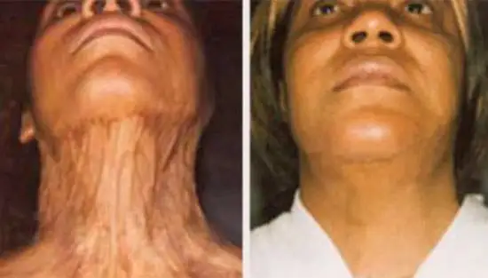 جراحی ترمیم صورت چگونه انجام می شود؟