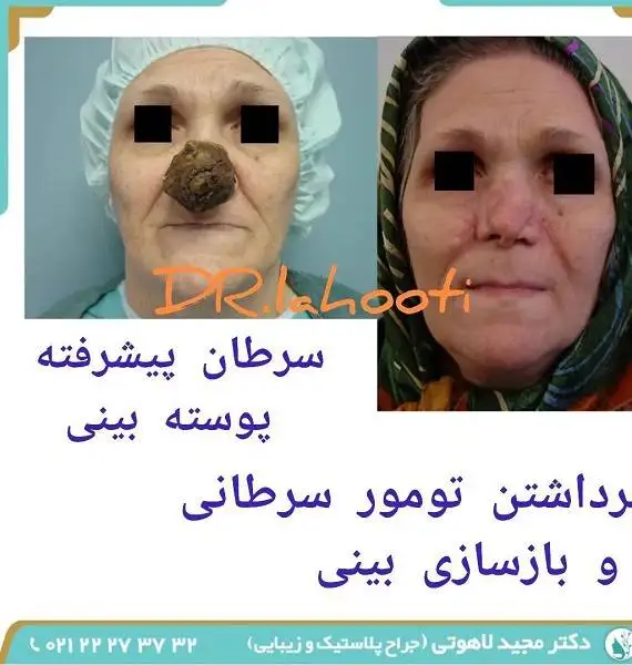 جراحی ترمیم صورت چگونه انجام می شود؟