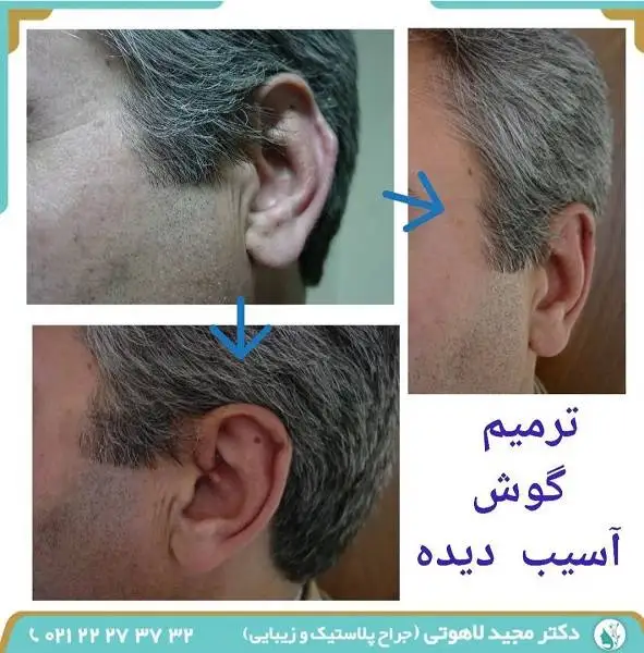 جراحی ترمیم صورت چگونه انجام می شود؟
