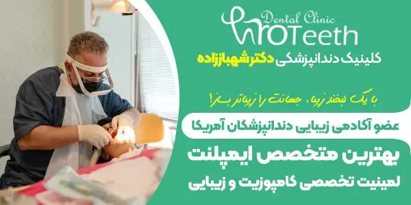 کامپوزیت دندان چیست؟