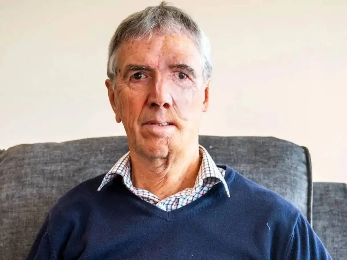 تصاویر؛ بازسازی شگفت انگیز چهره یک دوچرخه سوار پس از تصادف دلخراش