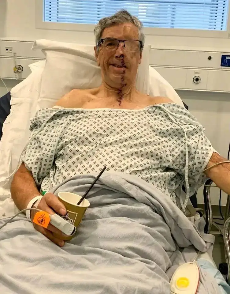 تصاویر؛ بازسازی شگفت انگیز چهره یک دوچرخه سوار پس از تصادف دلخراش