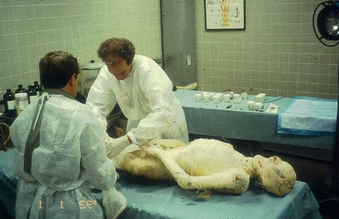 مردی که 30 سال پیش به روش مصر باستان «مومیایی» شد