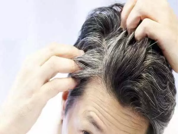 کمبود این ویتامین سبب سفیدی مو می شود