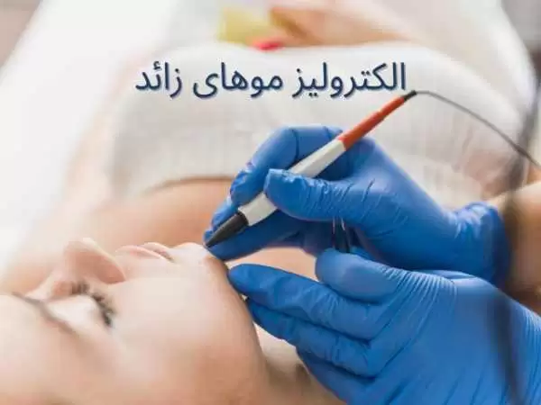 حذف دائمی و آسان موهای زائد با روش الکترولیز