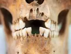 (عکس) وایکینگ ها با دندان های شان چه می کردند؟