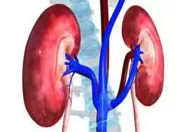 چگونه می توان فهمید کیست کلیه خطرناک است یا نه؟
