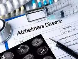نشانه های ابتلا به آلزایمر از چند سالگی شروع می شود؟