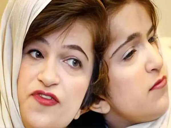 عکس؛ سفر در زمان؛ ظاهر «لاله و لادن» در دوران کودکی؛ دهه 50