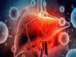 عواملی که ابتلا به کبد چرب را افزایش می دهد