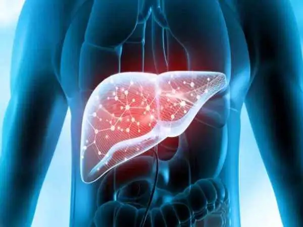 باورهای غلط برای درمان کبد چرب؛ این سه روش را فراموش کنید