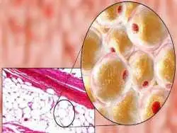 چربی سوزی بدون گرسنگی؟ ؛ کشف نقش طلایی سیستئین در کاهش وزن
