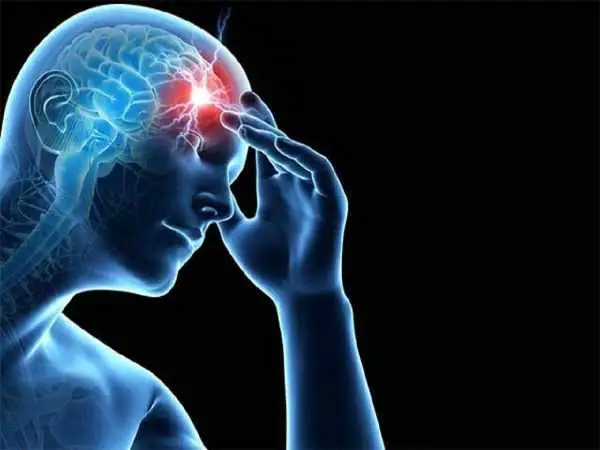 سکته های مغزی مکرر می توانند به زوال عقل عروقی منجر شوند