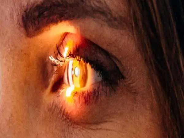 اگر می خواهید لاغر شوید مراقب بینایی خود باشید