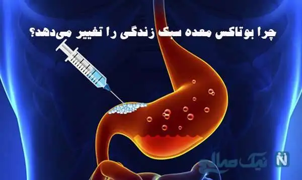 بوتاکس معده و تأثیر آن بر سبک زندگی: نکات جالب+ راهنمای کامل و کاربردی