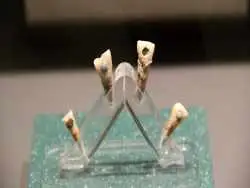 کشف دندان هایی با «نگین یشم» که متعلق به یک کودک هفت ساله بوده اند