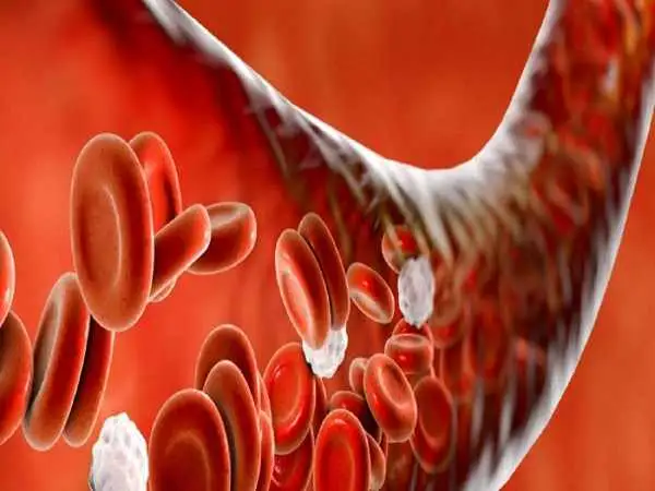 چند نکته درباره کم خونی و عوارض آن