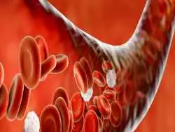 چند نکته درباره کم خونی و عوارض آن