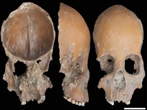 جمجمه های 5 هزارساله ای که به «کاسه» تبدیل شده اند